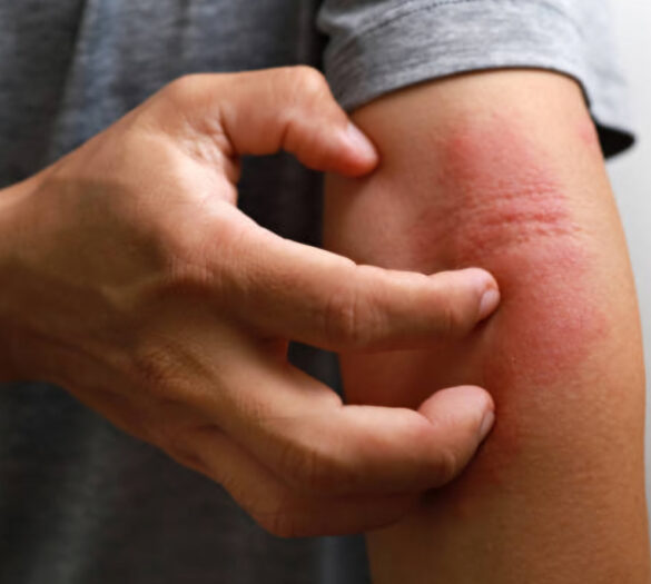 {{brizy_dc_image_alt imageSrc=